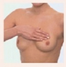recurrent breast cancer