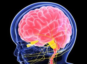 Parkinson Disease, Brain metastases