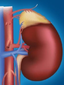Chronic Kidney Disease causes Symptoms Treatment
