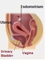 Vaginal Atrophy Symptoms Treamtent