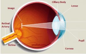 Nearsightedness, Myopia, Symptoms, Treatment