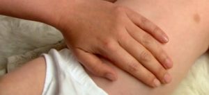 Colic, Infantile Colic, Infant Abdominal Pain CAUSES SYMPTOMS TREATMENT