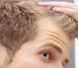 HAIR LOSS  SYMPTOMS CAUSES TREATMENT