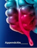 Appendicitis Symptoms Treatment