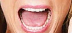 Burning Mouth Syndrome Symptoms Treatment